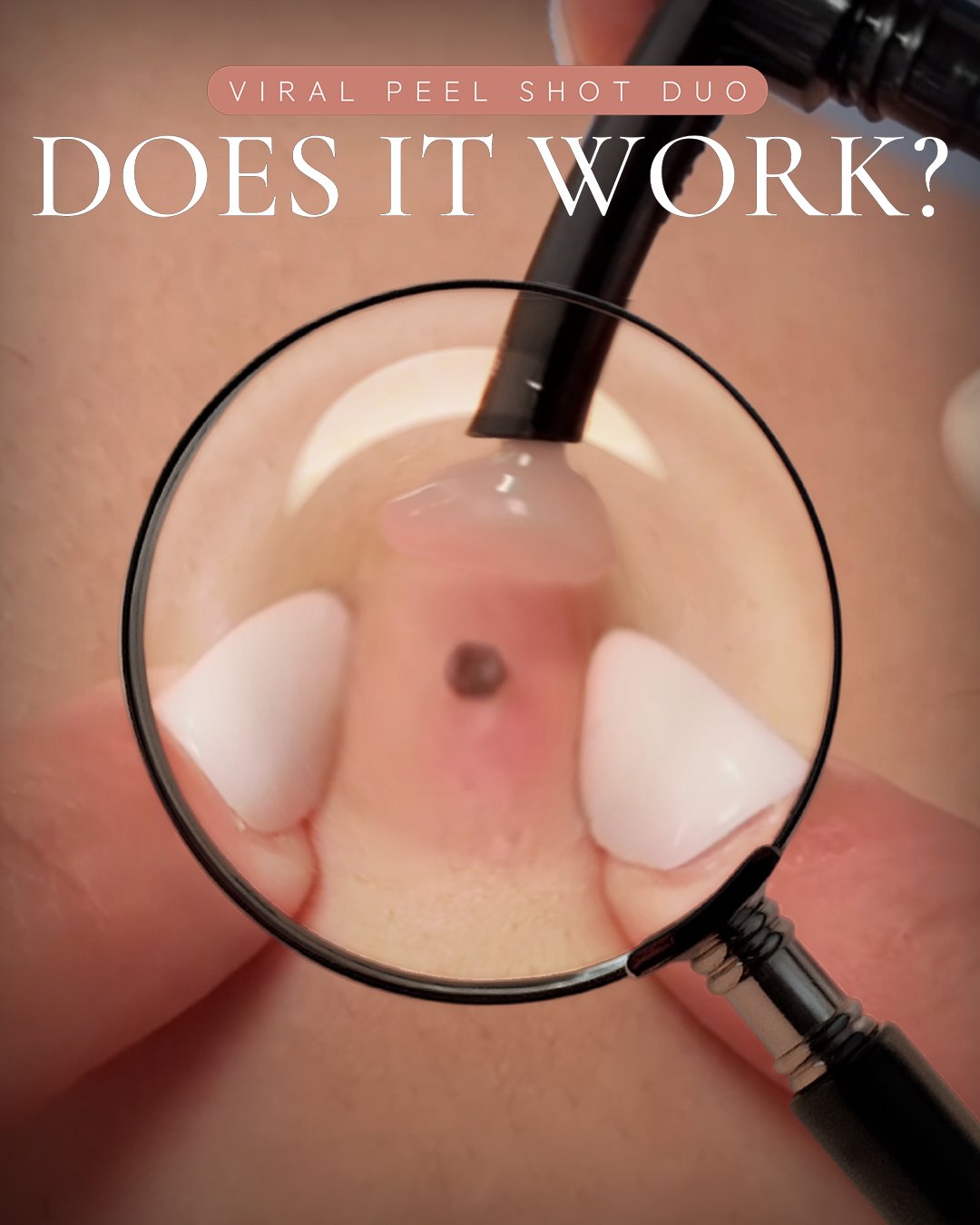 Viral Peel Shot Duo — Does It Work?